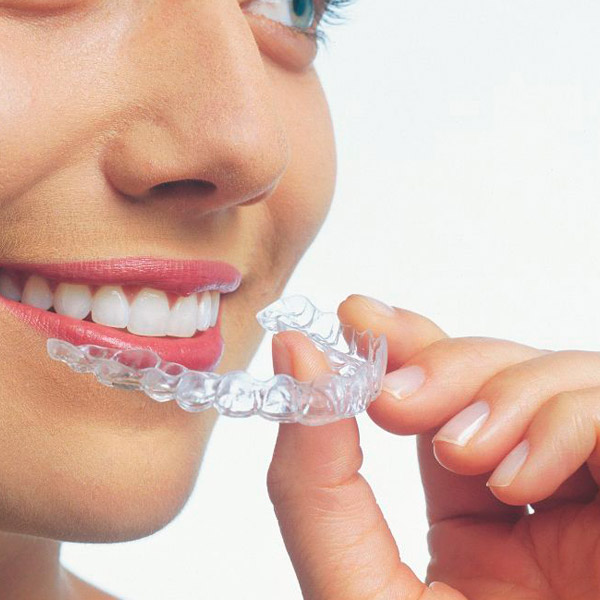 Ortodontia/Invisalign